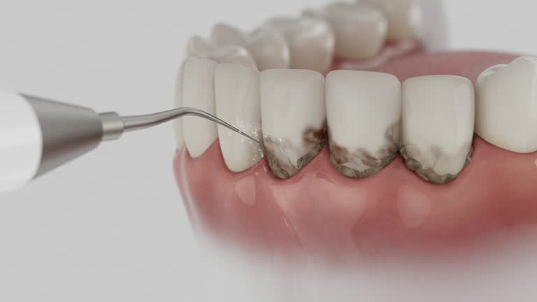 Reliable Dental Implants contractor in Grass Valley, CA by Smile Center Dentistry